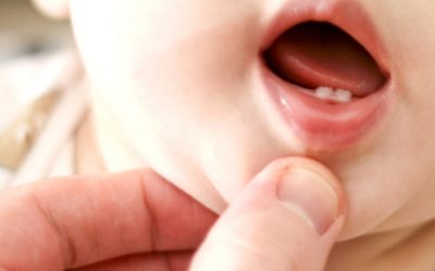 La réflexologie en pédiatrie – les dents